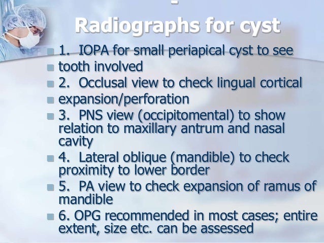 Cysts of the jaws
