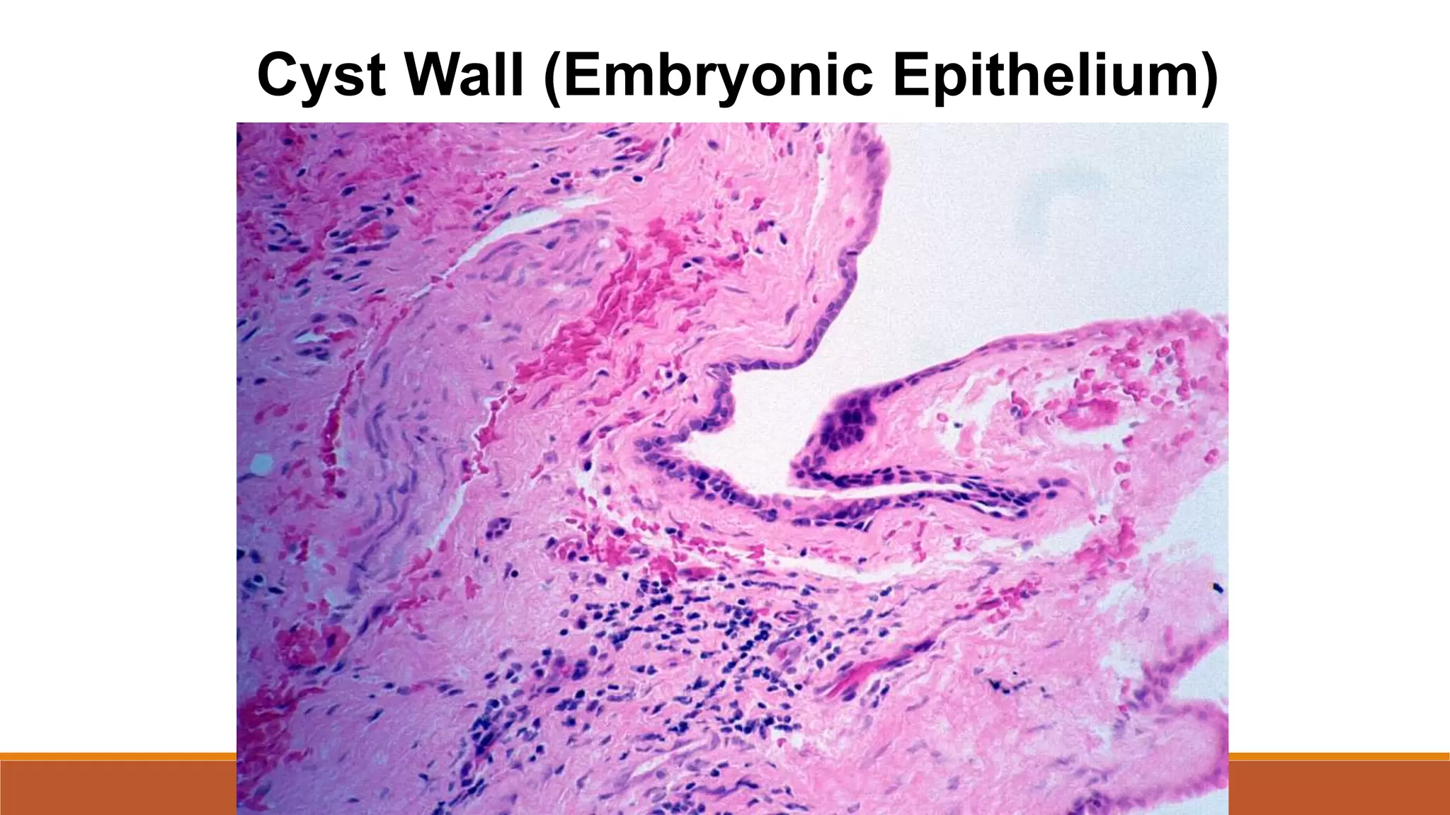 Cyst Wall (Embryonic Epithelium)