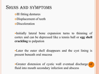 Cysts of jaw | PDF