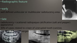 CystS in oral pathology dental edu[1].pptx