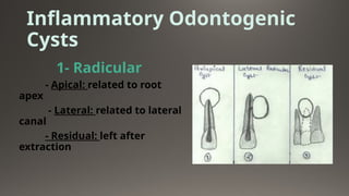 CystS in oral pathology dental edu[1].pptx