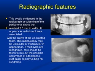 Radiographic features
 This cyst is evidenced in the
radiograph by widening of the
pericoronal space that
 reached 2.5 mm in width It
appears as radiolucent area
associated
with the crown of the un-erupted
tooth. This radiolucency may
be unilocular or multilocular in
appearance. If multicysts are
recognized, care should be
taken to rule out the possible
occurrence of odontogenic
cyst basal cell nevus bifid rib
syndrome.
 