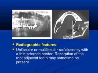  Radiographic features:
 Unilocular or multilocular radiolucency with
a thin sclerotic border. Resorption of the
root adjacent teeth may sometime be
present.
 