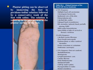  Plantar pitting can be observed
by immersing the foot in
povidone-iodine solution followed
by a conservative wash of the
foot with saline. The solution is
taken up in the pits present in the
plantar surface of the foot.
 