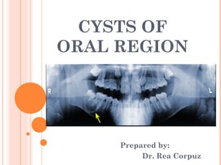 CYSTS OF
ORAL REGION




     Prepared by:
          Dr. Rea Corpuz
 
