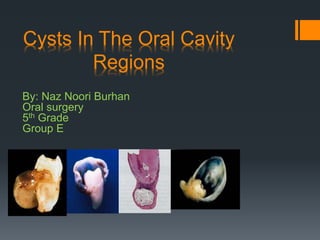 Cysts In The Oral Cavity 
Regions 
By: Naz Noori Burhan 
Oral surgery 
5th Grade 
Group E 
 