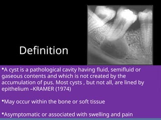 Comprehensive Overview of Oral and Maxillofacial Cysts: Types, Features ...