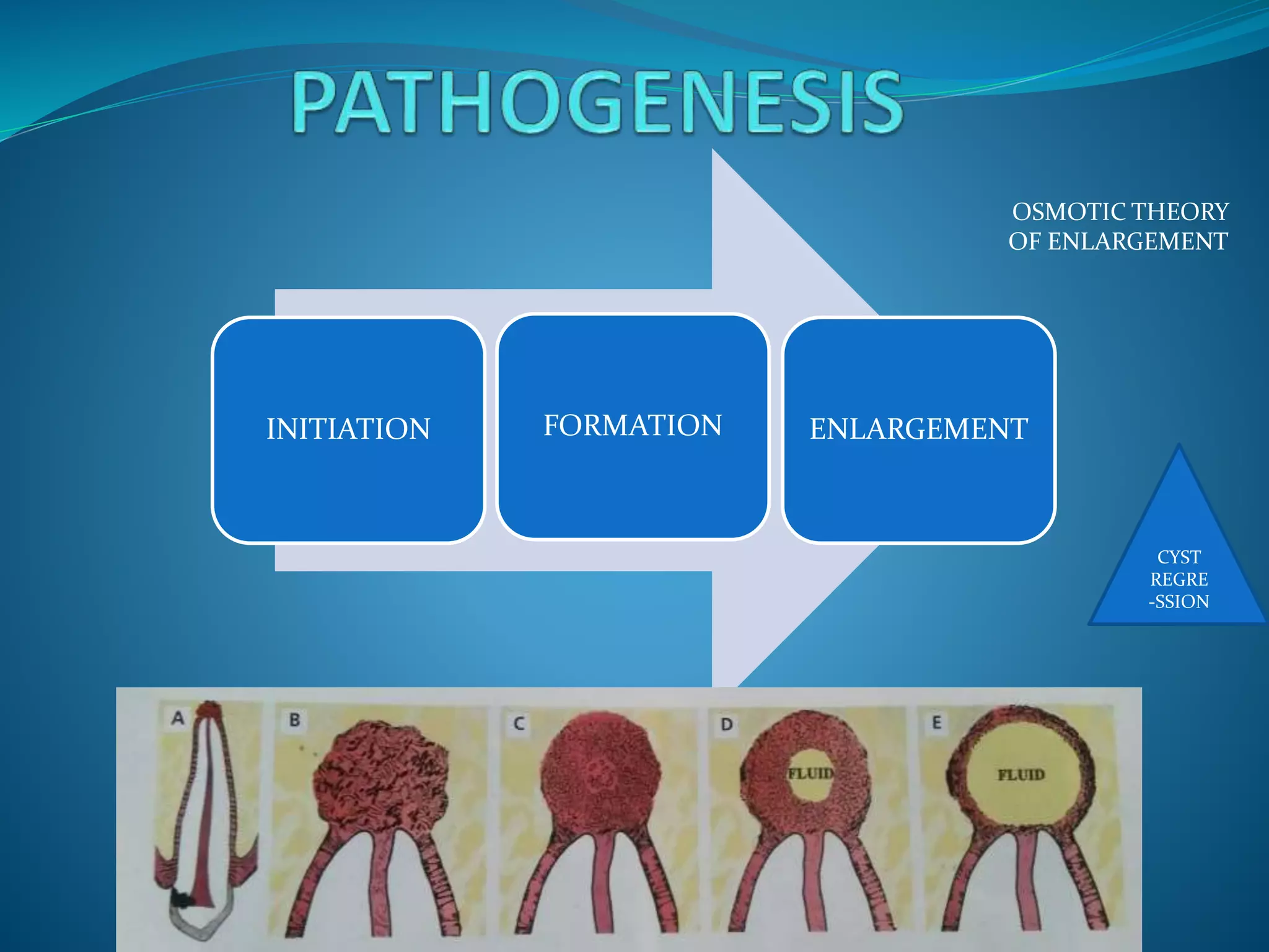 OSMOTIC THEORY
OF ENLARGEMENT
INITIATION FORMATION ENLARGEMENT
CYST
REGRE
-SSION
 