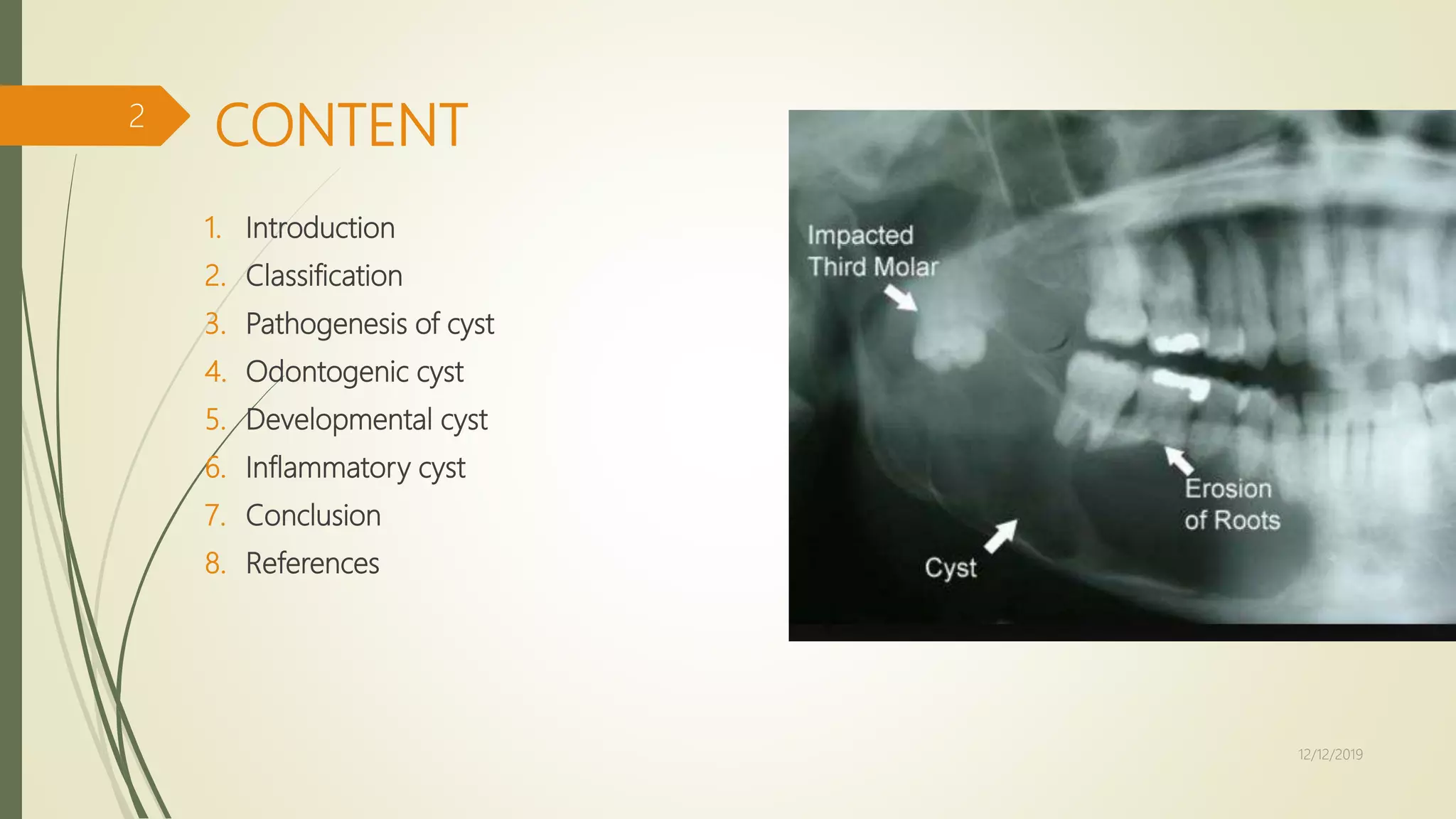 Cysts of the jaws | PPTX