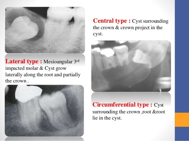 Cysts and tumors in pediatric dentistry