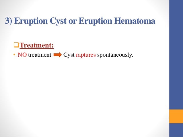Cysts and tumors in pediatric dentistry
