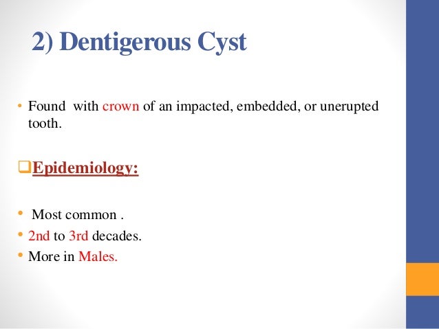 Cysts and tumors in pediatric dentistry