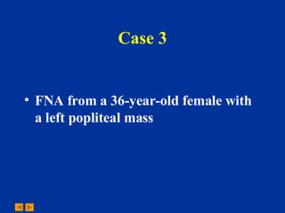 Case 3 FNA from a 36-year-old female with a left popliteal mass