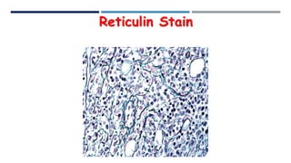 Anti Reticulin Cytochemistry ii | PDF