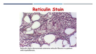Anti Reticulin Cytochemistry ii | PDF