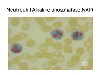 Cytochemistry Stian.ppt heamatology leukemia of white blood cells | PPT