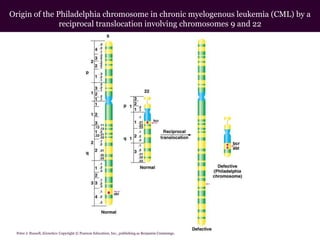 Origin of the Philadelphia chromosome in chronic myelogenous leukemia (CML) by a
reciprocal translocation involving chromosomes 9 and 22

Peter J. Russell, iGenetics: Copyright © Pearson Education, Inc., publishing as Benjamin Cummings.

 