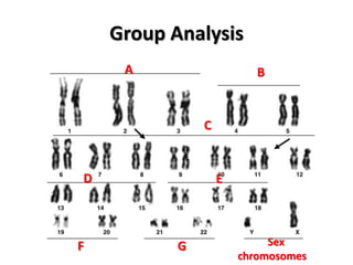 Group Analysis
A

B

C

D

F

E

G

Sex
chromosomes

 