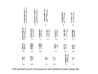 GTG banded human chromosomes with banded cartoon along side

 