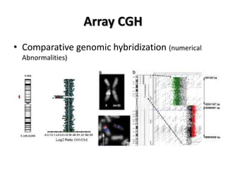 Array CGH
• Comparative genomic hybridization (numerical
Abnormalities)

 