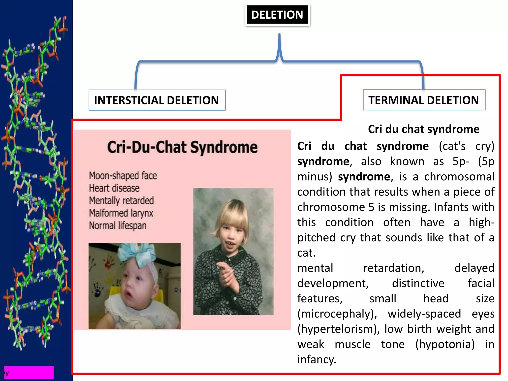 DELETION
INTERSTICIAL DELETION TERMINAL DELETION
Cri du chat syndrome
Cri du chat syndrome (cat's cry)
syndrome, also known as 5p- (5p
minus) syndrome, is a chromosomal
condition that results when a piece of
chromosome 5 is missing. Infants with
this condition often have a high-
pitched cry that sounds like that of a
cat.
mental retardation, delayed
development, distinctive facial
features, small head size
(microcephaly), widely-spaced eyes
(hypertelorism), low birth weight and
weak muscle tone (hypotonia) in
infancy.
 