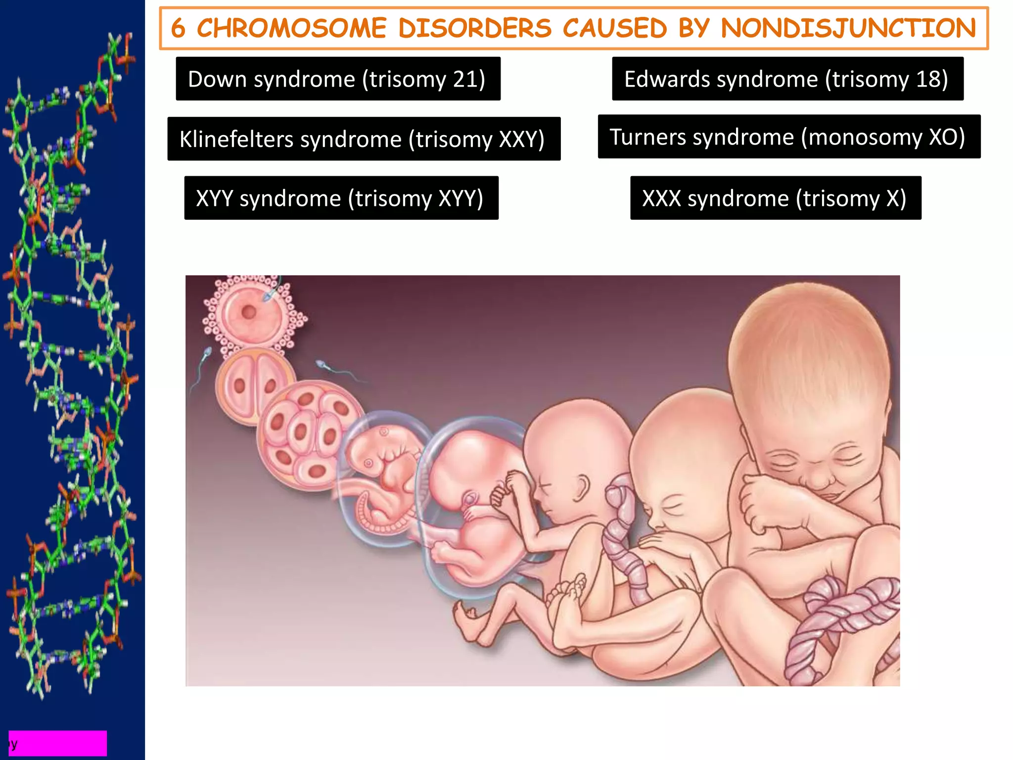 6 CHROMOSOME DISORDERS CAUSED BY NONDISJUNCTION
Down syndrome (trisomy 21) Edwards syndrome (trisomy 18)
Klinefelters syndrome (trisomy XXY)
XYY syndrome (trisomy XYY) XXX syndrome (trisomy X)
Turners syndrome (monosomy XO)
 