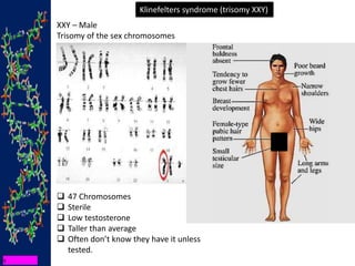 Klinefelters syndrome (trisomy XXY)
XXY – Male
Trisomy of the sex chromosomes
 47 Chromosomes
 Sterile
 Low testosterone
 Taller than average
 Often don’t know they have it unless
tested.
 
