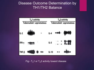 Disease Outcome Determination by
TH1/TH2 Balance
Fig:- TH1 or TH2 activity toward disease
 