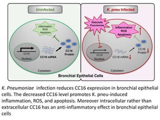 Cytokines in lung and pleural diseases.pptx