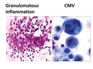 diagnostic Cytology introduction , Body fluids cytology | PPTX