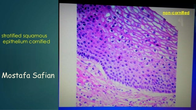 Cornify Example Cornified Vs Non Cornified : A computational model of the epidermis ...