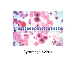 cytomegalovirus

Cytomegalovirus

 