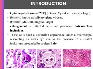 Microbiology of Cytomegalovirus (Herpes).pptx