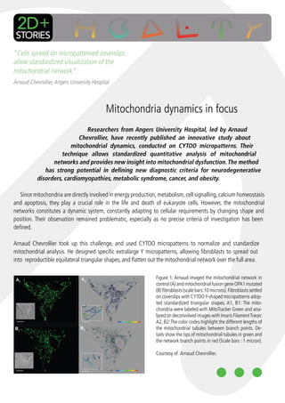 “Cells spread on micropatterned coverslips
allow standardized visualization of the
mitochondrial network”
Arnaud Chevrollier, Angers University Hospital



                                            Mitochondria dynamics in focus
                               Researchers from Angers University Hospital, led by Arnaud
                            Chevrollier, have recently published an innovative study about
                        mitochondrial dynamics, conducted on CYTOO micropatterns. Their
                     technique allows standardized quantitative analysis of mitochondrial
                 networks and provides new insight into mitochondrial dysfunction. The method
              has strong potential in defining new diagnostic criteria for neurodegenerative
           disorders, cardiomyopathies, metabolic syndrome, cancer, and obesity.

   Since mitochondria are directly involved in energy production, metabolism, cell signalling, calcium homeostasis
and apoptosis, they play a crucial role in the life and death of eukaryote cells. However, the mitochondrial
networks constitutes a dynamic system, constantly adapting to cellular requirements by changing shape and
position. Their observation remained problematic, especially as no precise criteria of investigation has been
defined.

Arnaud Chevrollier took up this challenge, and used CYTOO micropatterns to normalize and standardize
mitochondrial analysis. He designed specific extralarge Y micropatterns, allowing fibroblasts to spread out
into reproductible equilateral triangular shapes, and flatten out the mitochondrial network over the full area.

                                                                Figure 1: Arnaud imaged the mitochondrial network in
                                                                control (A) and mitochondrial fusion gene OPA1 mutated
                                                                (B) fibroblasts (scale bars:10 microns). Fibroblasts settled
                                                                on coverslips with CYTOO Y-shaped micropatterns adop-
                                                                ted standardized triangular shapes. A1, B1: The mito-
                                                                chondria were labeled with MitoTracker Green and ana-
                                                                lyzed on deconvolved images with Imaris Filament Tracer.
                                                                A2, B2: The color codes highlight the different lengths of
                                                                the mitochondrial tubules between branch points. De-
                                                                tails show the tips of mitochondrial tubules in green and
                                                                the network branch points in red (Scale bars : 1 micron).

                                                                Courtesy of Arnaud Chevrollier.
 