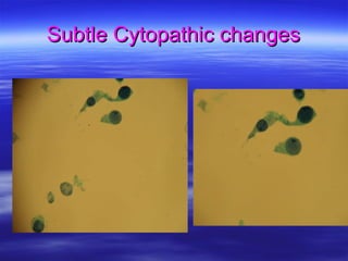 Cytopathic Effects Of Viral Infections | PPT