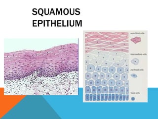 SQUAMOUS
EPITHELIUM
 