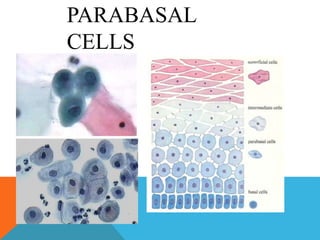 PARABASAL
CELLS
 