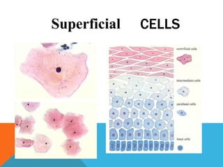 Superficial CELLS
 