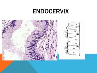 ENDOCERVIX
 