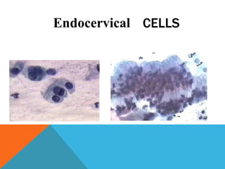 Endocervical CELLS
 