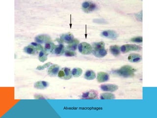 Alveolar macrophages
 