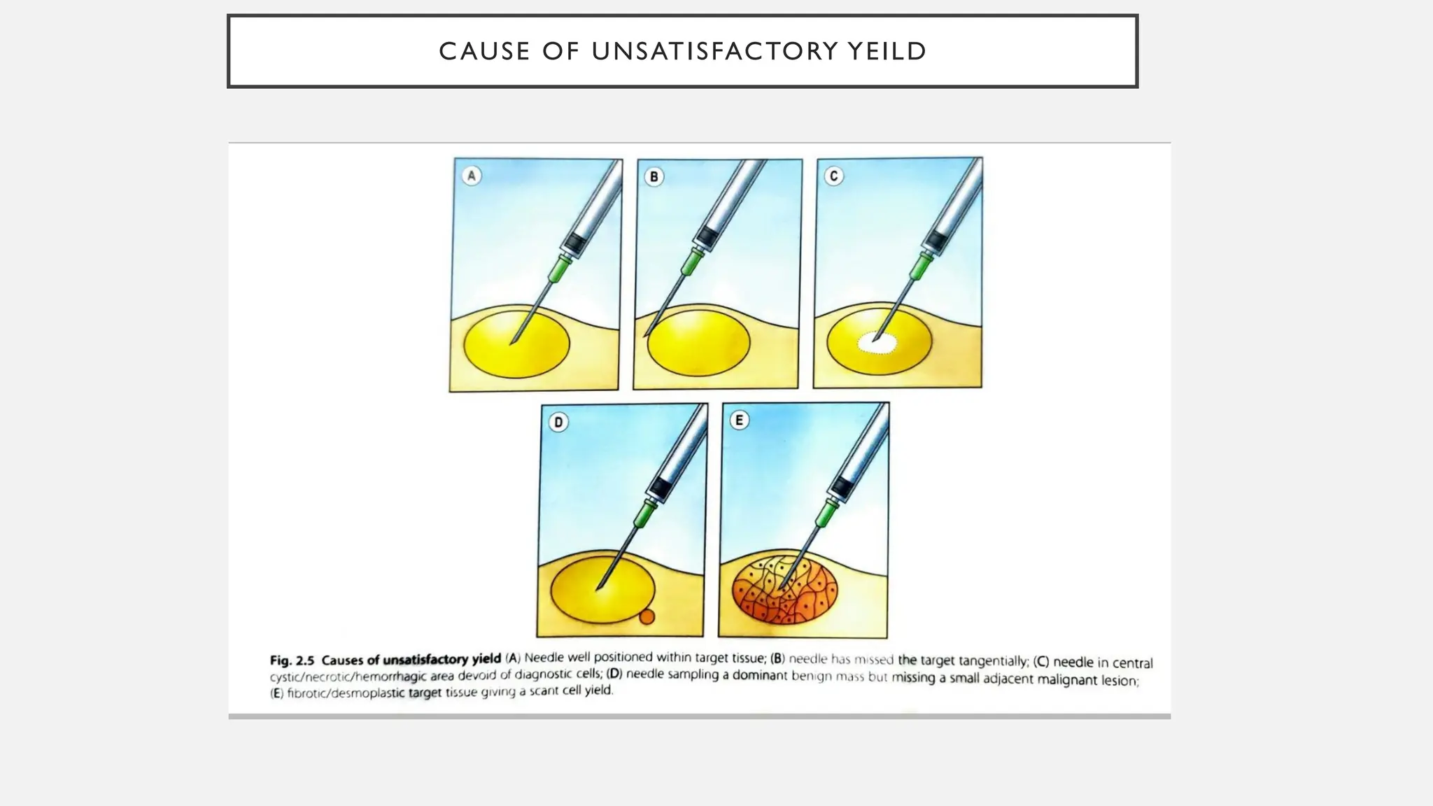 CAUSE OF UNSATISFACTORY YEILD
 