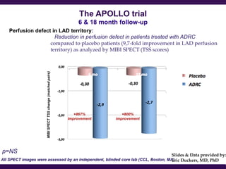 The APOLLO trial
                                                                   6 & 18 month follow-up
   Perfusion defect in LAD territory:
                     Reduction in perfusion defect in patients treated with ADRC
                   compared to placebo patients (9,7-fold improvement in LAD perfusion
                   territory) as analyzed by MIBI SPECT (TSS scores)
                      MIBI SPECT TSS change (matched pairs)




                                                                 +867%           +800%
                                                              improvement     improvement




p=NS
                                                                                   Slides & Data provided by:
All SPECT images were assessed by an independent, blinded core lab (CCL, Boston, MA) Duckers, MD, PhD
                                                                                   Eric
 