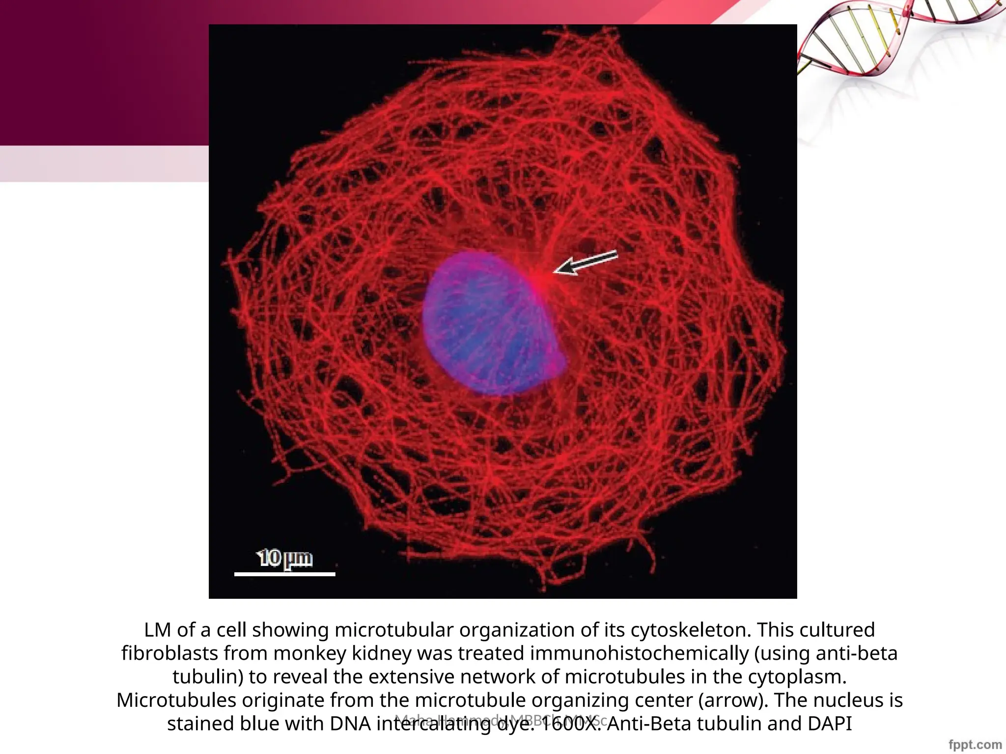 Maha Hammady,MBBCh,MMSc
LM of a cell showing microtubular organization of its cytoskeleton. This cultured
fibroblasts from monkey kidney was treated immunohistochemically (using anti-beta
tubulin) to reveal the extensive network of microtubules in the cytoplasm.
Microtubules originate from the microtubule organizing center (arrow). The nucleus is
stained blue with DNA intercalating dye. 1600X. Anti-Beta tubulin and DAPI
 
