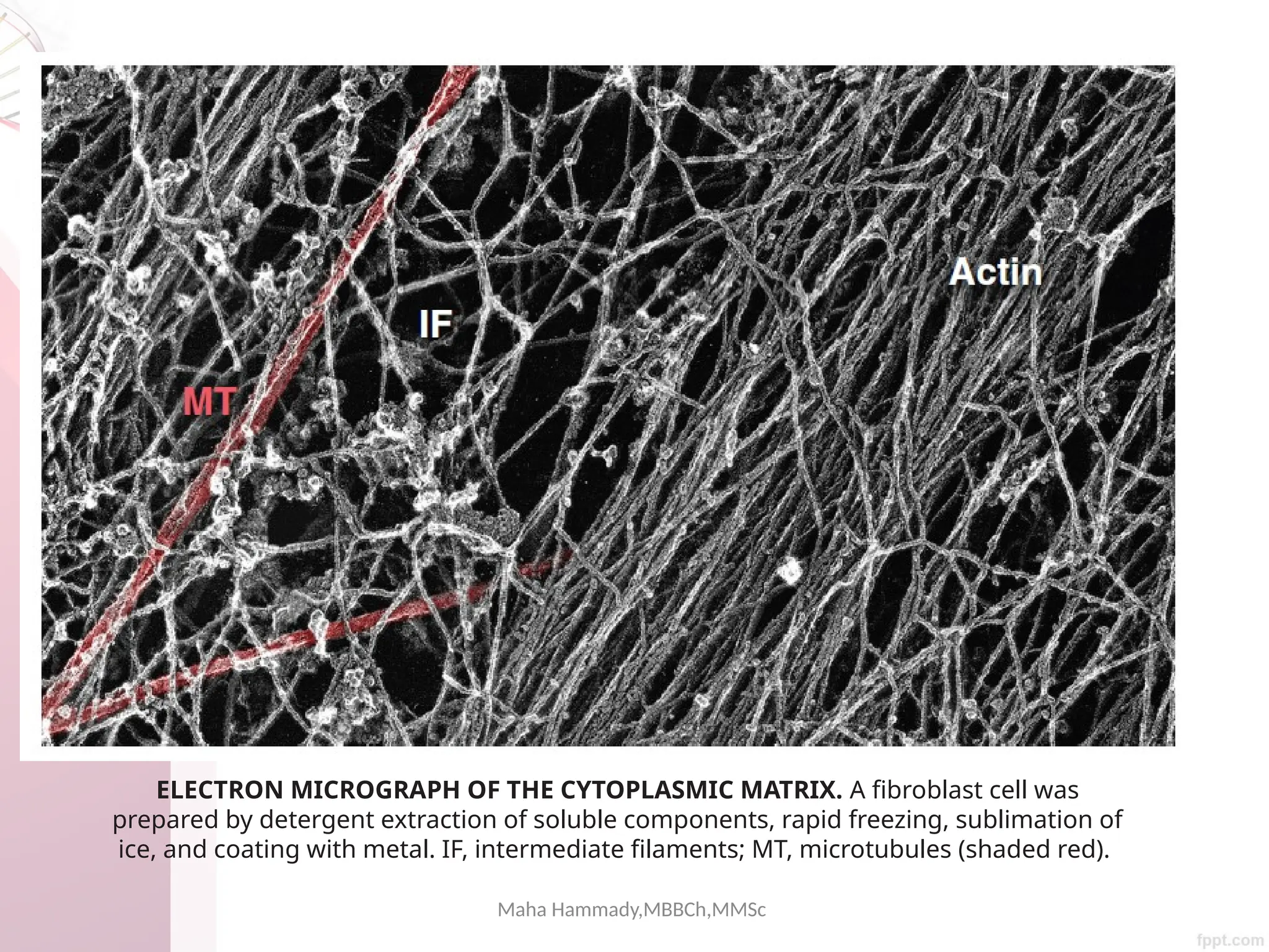 Maha Hammady,MBBCh,MMSc
ELECTRON MICROGRAPH OF THE CYTOPLASMIC MATRIX. A fibroblast cell was
prepared by detergent extraction of soluble components, rapid freezing, sublimation of
ice, and coating with metal. IF, intermediate filaments; MT, microtubules (shaded red).
 