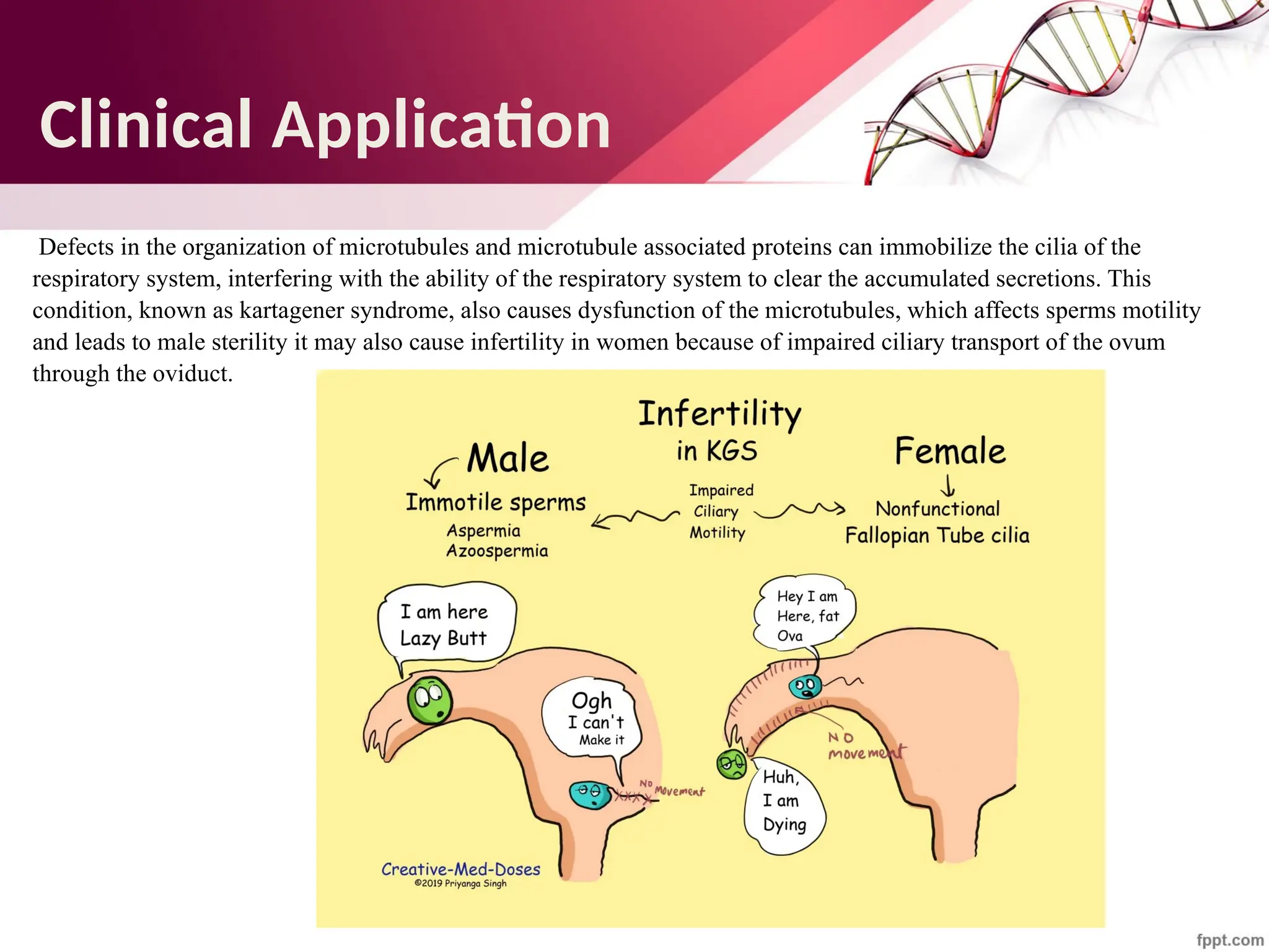 Maha Hammady,MBBCh,MMSc
Defects in the organization of microtubules and microtubule associated proteins can immobilize the cilia of the
respiratory system, interfering with the ability of the respiratory system to clear the accumulated secretions. This
condition, known as kartagener syndrome, also causes dysfunction of the microtubules, which affects sperms motility
and leads to male sterility it may also cause infertility in women because of impaired ciliary transport of the ovum
through the oviduct.
Clinical Application
 