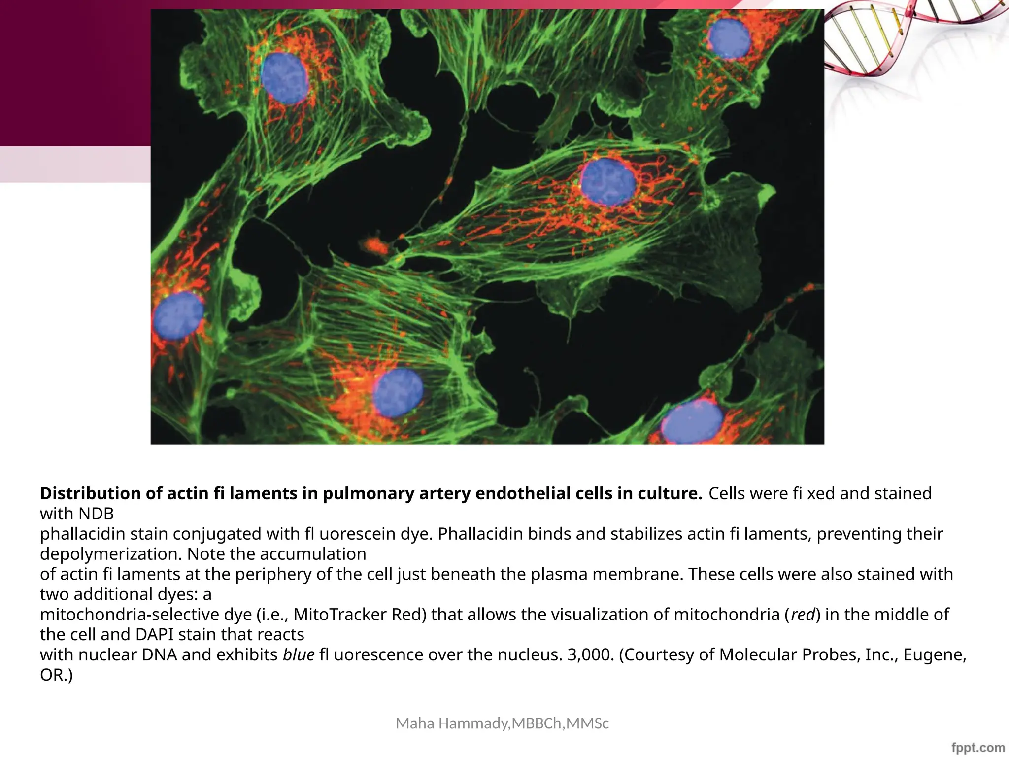Maha Hammady,MBBCh,MMSc
Distribution of actin fi laments in pulmonary artery endothelial cells in culture. Cells were fi xed and stained
with NDB
phallacidin stain conjugated with fl uorescein dye. Phallacidin binds and stabilizes actin fi laments, preventing their
depolymerization. Note the accumulation
of actin fi laments at the periphery of the cell just beneath the plasma membrane. These cells were also stained with
two additional dyes: a
mitochondria-selective dye (i.e., MitoTracker Red) that allows the visualization of mitochondria (red) in the middle of
the cell and DAPI stain that reacts
with nuclear DNA and exhibits blue fl uorescence over the nucleus. 3,000. (Courtesy of Molecular Probes, Inc., Eugene,
OR.)
 