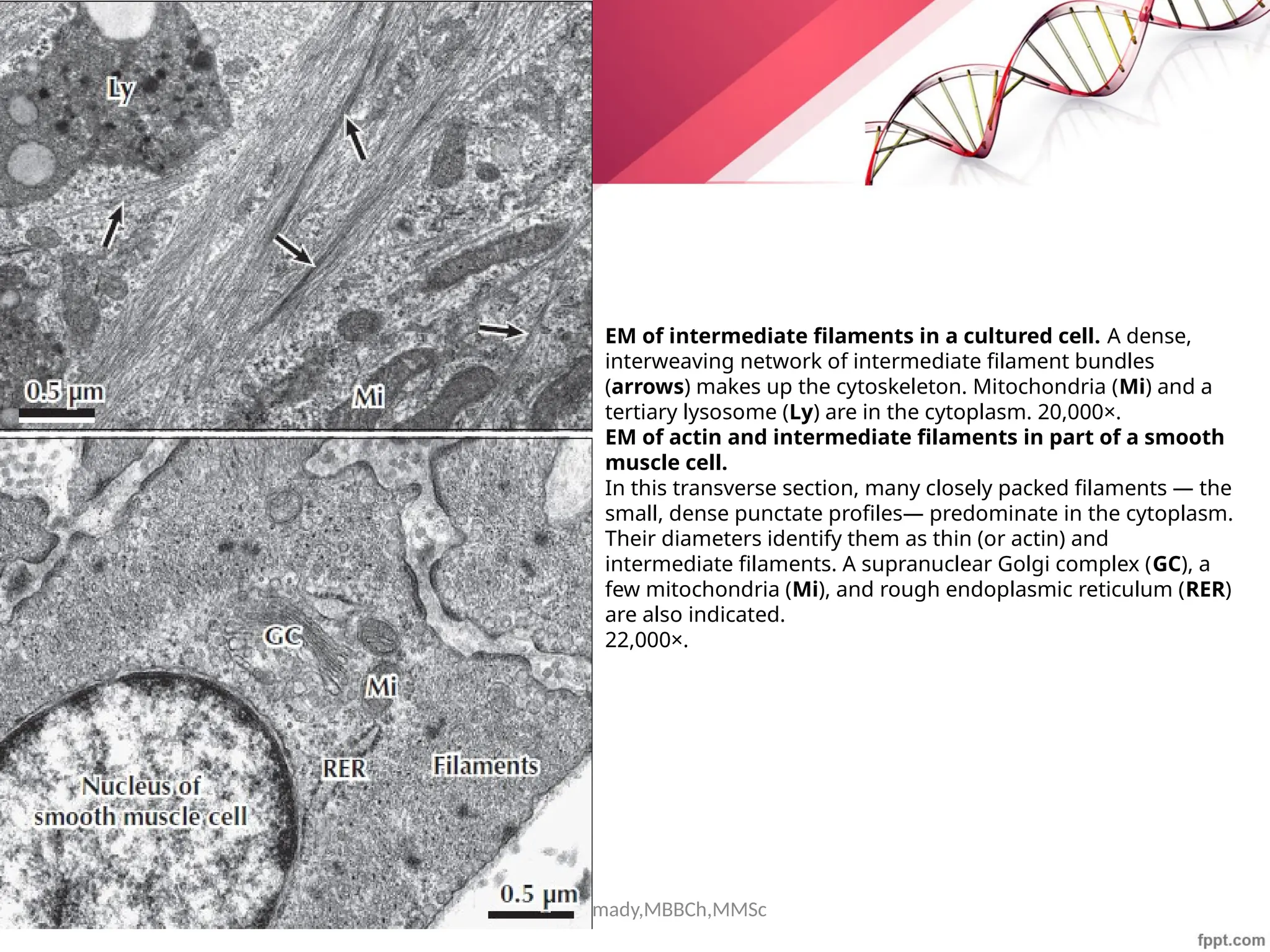Maha Hammady,MBBCh,MMSc
EM of intermediate filaments in a cultured cell. A dense,
interweaving network of intermediate filament bundles
(arrows) makes up the cytoskeleton. Mitochondria (Mi) and a
tertiary lysosome (Ly) are in the cytoplasm. 20,000×.
EM of actin and intermediate filaments in part of a smooth
muscle cell.
In this transverse section, many closely packed filaments — the
small, dense punctate profiles— predominate in the cytoplasm.
Their diameters identify them as thin (or actin) and
intermediate filaments. A supranuclear Golgi complex (GC), a
few mitochondria (Mi), and rough endoplasmic reticulum (RER)
are also indicated.
22,000×.
 