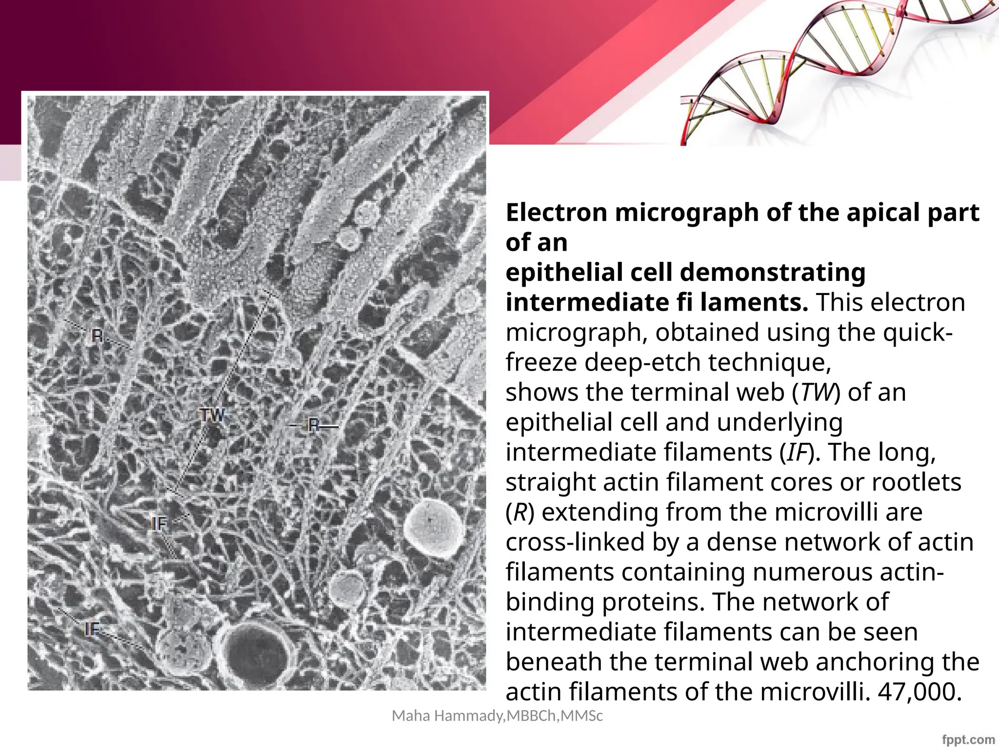 Maha Hammady,MBBCh,MMSc
Electron micrograph of the apical part
of an
epithelial cell demonstrating
intermediate fi laments. This electron
micrograph, obtained using the quick-
freeze deep-etch technique,
shows the terminal web (TW) of an
epithelial cell and underlying
intermediate filaments (IF). The long,
straight actin filament cores or rootlets
(R) extending from the microvilli are
cross-linked by a dense network of actin
filaments containing numerous actin-
binding proteins. The network of
intermediate filaments can be seen
beneath the terminal web anchoring the
actin filaments of the microvilli. 47,000.
 