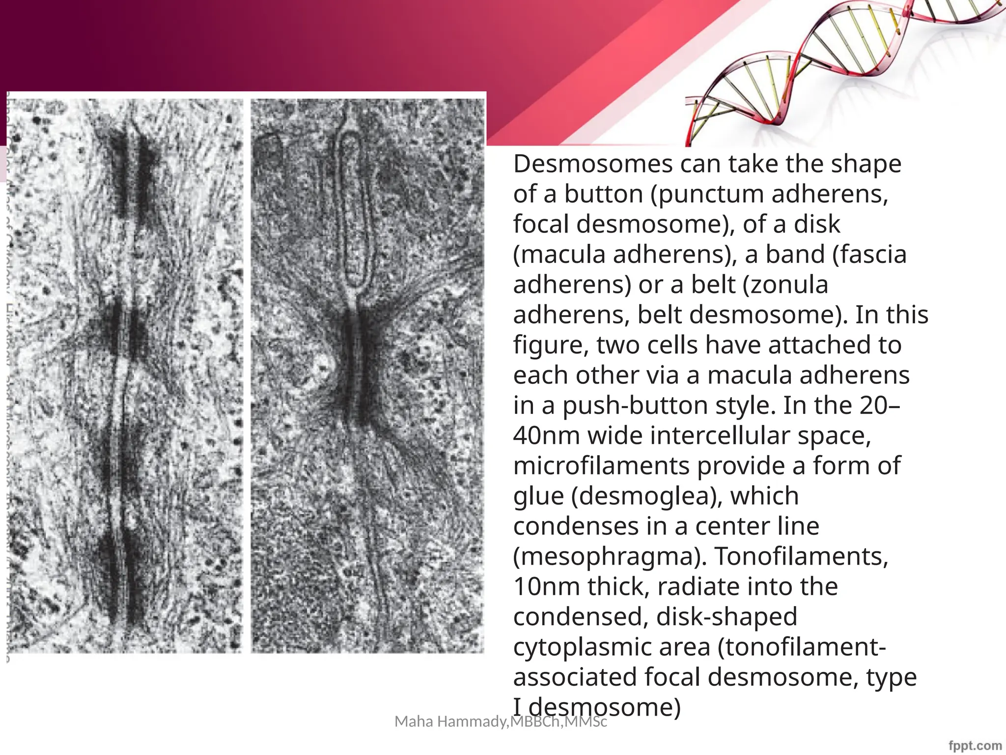 Maha Hammady,MBBCh,MMSc
Desmosomes can take the shape
of a button (punctum adherens,
focal desmosome), of a disk
(macula adherens), a band (fascia
adherens) or a belt (zonula
adherens, belt desmosome). In this
figure, two cells have attached to
each other via a macula adherens
in a push-button style. In the 20–
40nm wide intercellular space,
microfilaments provide a form of
glue (desmoglea), which
condenses in a center line
(mesophragma). Tonofilaments,
10nm thick, radiate into the
condensed, disk-shaped
cytoplasmic area (tonofilament-
associated focal desmosome, type
I desmosome)
 